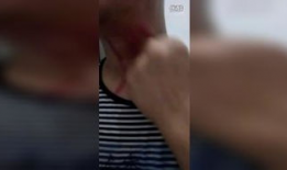 扯痧视频,传统养生新体验